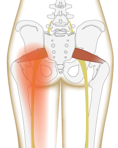 Pain in the butt: piriformis