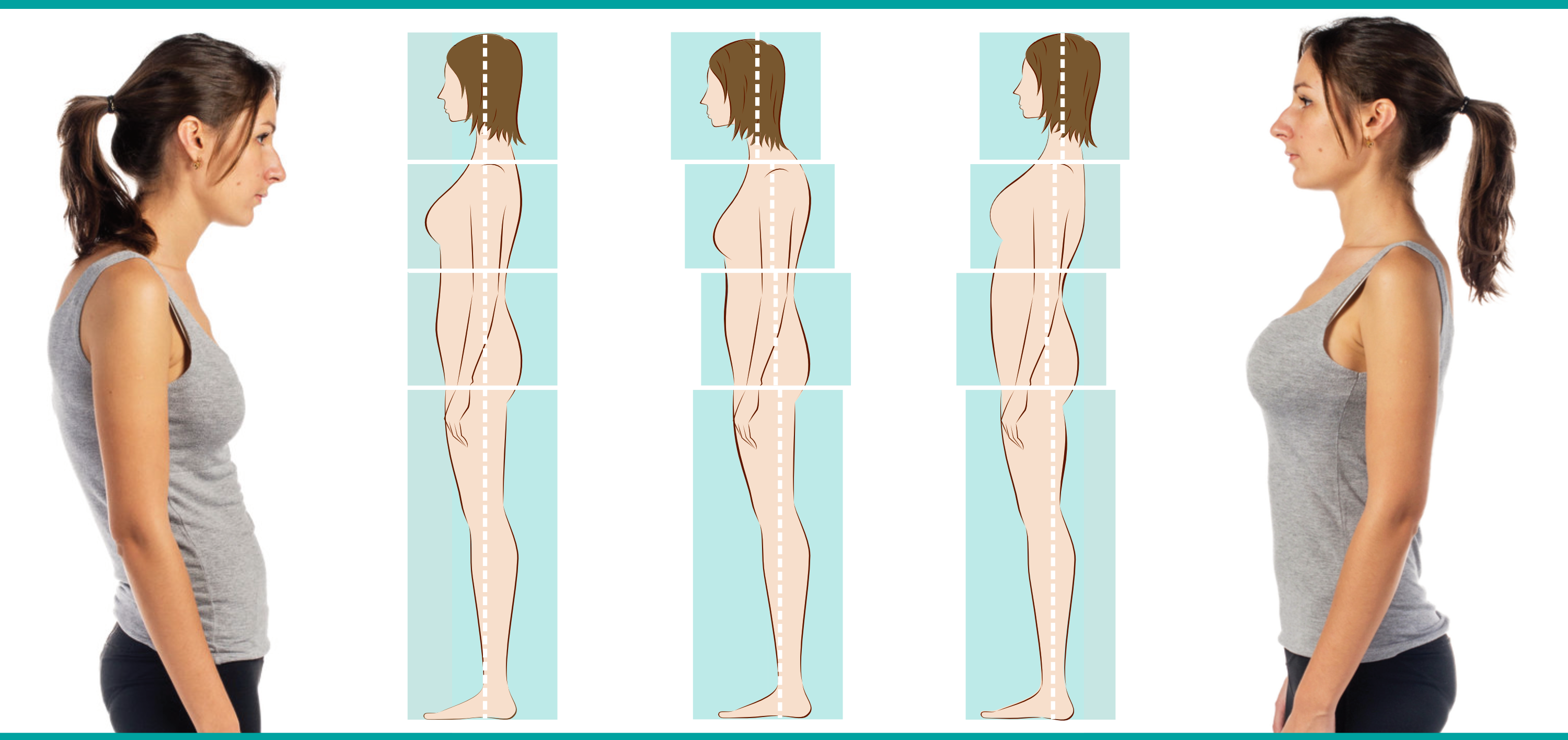 How Your Posture is Affecting Your SP
